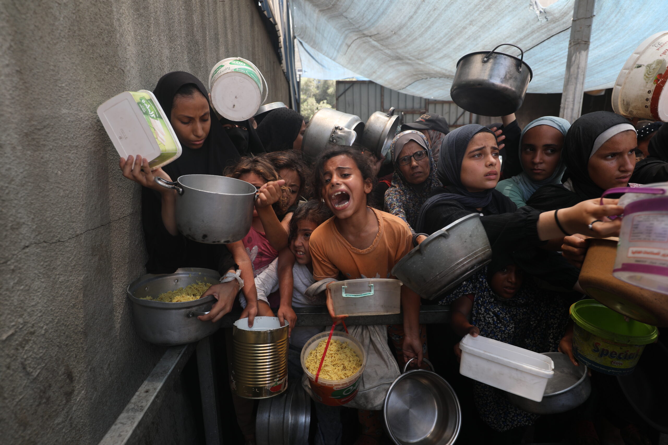 Bari Weiss’s Free Press Wants You to Know Some Kids Being Starved by Israel Were Already Sick